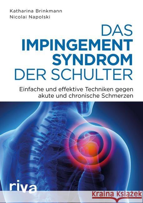 Das Impingement-Syndrom der Schulter : Einfache und effektive Techniken gegen akute und chronische Schmerzen Napolski, Nicolai; Brinkmann, Katharina 9783742305008 riva - książka