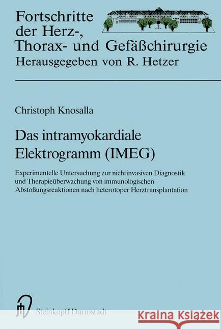 Das Intramyokardiale Elektrogramm (Imeg): Experimentelle Untersuchungen Zur Nichtinvasiven Diagnostik Und Therapieüberwachung Von Immunologischen Abst Knosalla, Christoph 9783798510043 Not Avail - książka
