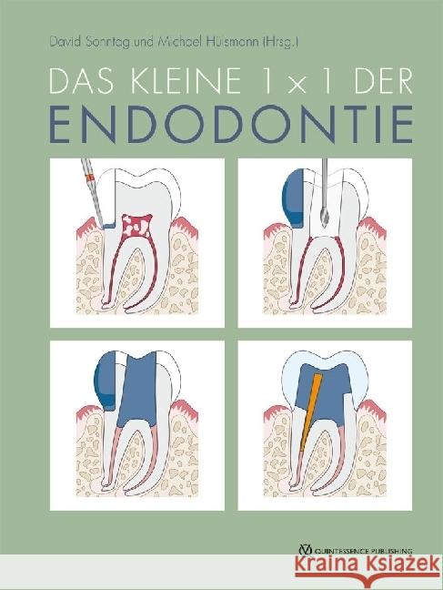 Das kleine 1x1 der Endodontie Sonntag, David, Hülsmann, Michael 9783868676112 Quintessenz, Berlin - książka