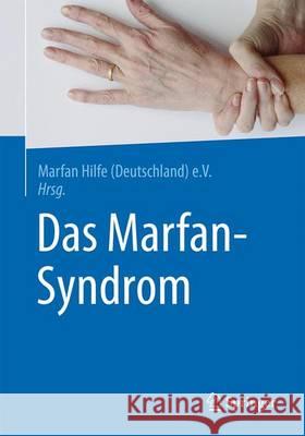 Das Marfan-Syndrom Marfan Hilfe (Deutschland) E V 9783662532584 Springer - książka