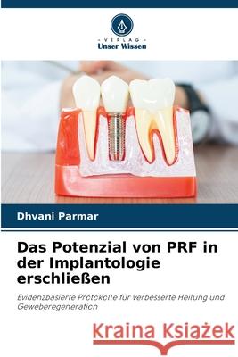 Das Potenzial von PRF in der Implantologie erschließen Parmar, Dhvani 9786208817152 Verlag Unser Wissen - książka