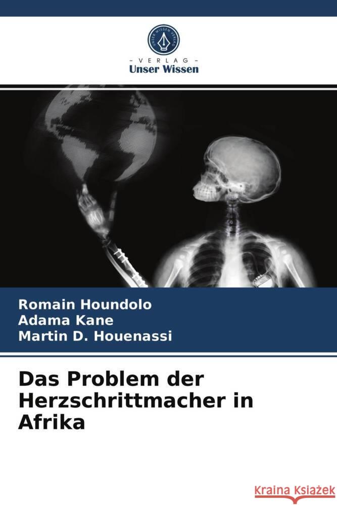 Das Problem der Herzschrittmacher in Afrika Houndolo, Romain, Kane, Adama, Houenassi, Martin D. 9786203983814 Verlag Unser Wissen - książka