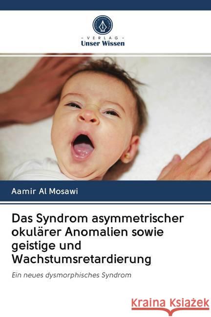 Das Syndrom asymmetrischer okulärer Anomalien sowie geistige und Wachstumsretardierung : Ein neues dysmorphisches Syndrom Al Mosawi, Aamir 9786202609937 Sciencia Scripts - książka