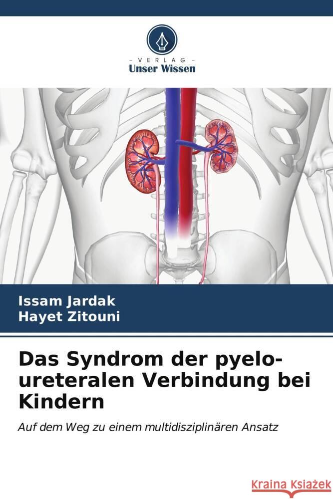 Das Syndrom der pyelo-ureteralen Verbindung bei Kindern JARDAK, Issam, Zitouni, Hayet 9786206631699 Verlag Unser Wissen - książka