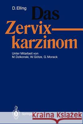 Das Zervixkarzinom Dirk Elling 9783540529569 Not Avail - książka