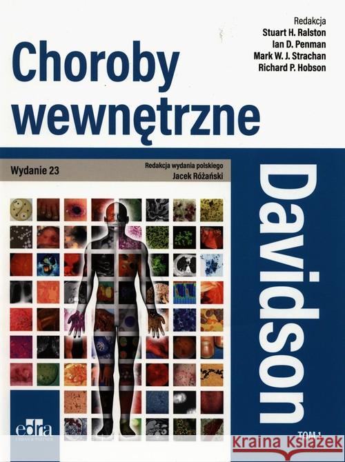 Davidson Choroby wewnętrzne. Tom 1 Ralston S.H. Strachan M.W.J. Penman D. 9788366310841 Edra Urban & Partner - książka