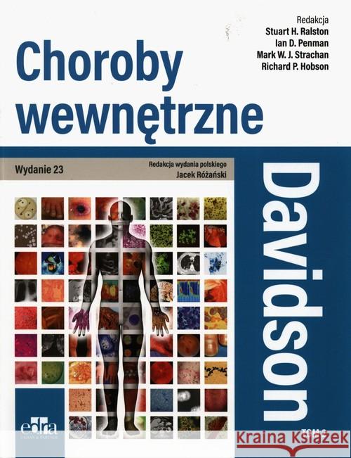 Davidson Choroby wewnętrzne Tom 2 Ralston Stuart H. Strachan Mark W.J. Penman Ian D. 9788366310858 Edra Urban & Partner - książka