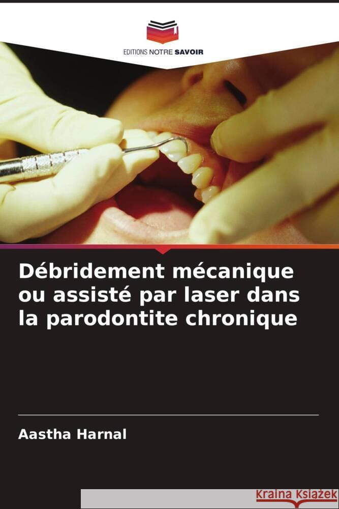 Débridement mécanique ou assisté par laser dans la parodontite chronique Aastha Harnal 9786205375679 Editions Notre Savoir - książka