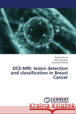 Dce-MRI: Lesion Detection and Classification in Breast Cancer Fusco Roberta, Sansone Mario, Petrillo Antonella 9783659427572 LAP Lambert Academic Publishing - książka