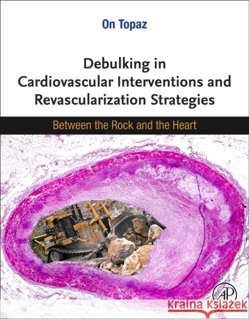 Debulking in Cardiovascular Interventions and Revascularization Strategies: Between the Rock and the Heart On Topaz 9780128214510 Academic Press - książka