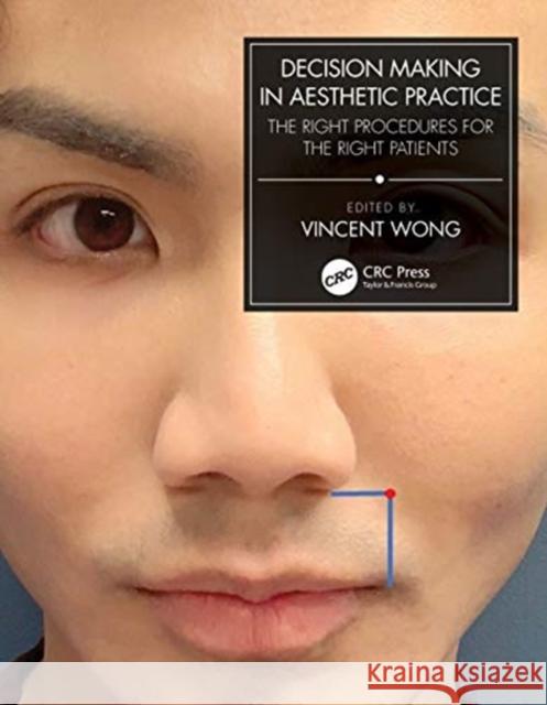 Decision Making in Aesthetic Practice: The Right Procedures for the Right Patients Vincent Wong 9780367769802 CRC Press - książka