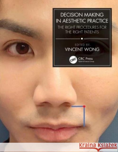 Decision Making in Aesthetic Practice: The Right Procedures for the Right Patients Vincent Wong 9781032046037 CRC Press - książka