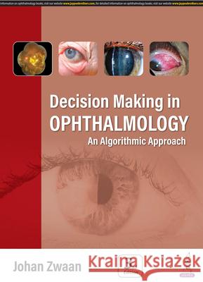 Decision Making in Ophthalmology Johan Zwaan 9789356966727 Jaypee Brothers Medical Publishers - książka