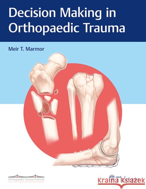 Decision Making in Orthopaedic Trauma Meir Marmor 9781626234611 Thieme Medical Publishers - książka