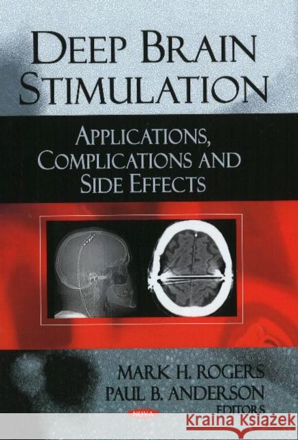 Deep Brain Stimulation: Applications, Complications & Side Effects Mark H Rogers, Paul B Anderson 9781606928950 Nova Science Publishers Inc - książka