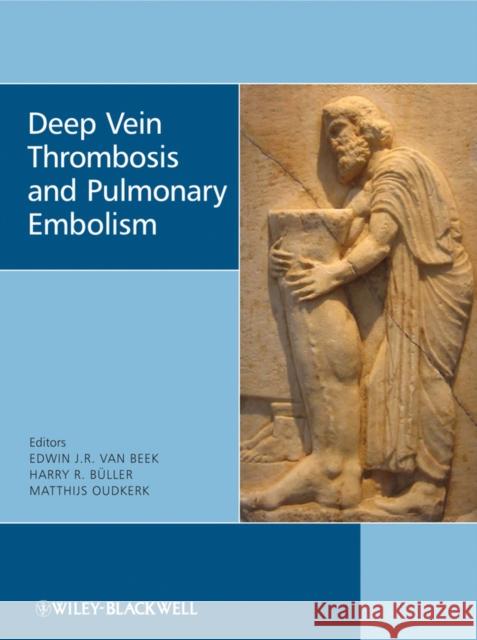 Deep Vein Thrombosis and Pulmonary Embolism  9780470517178 JOHN WILEY AND SONS LTD - książka