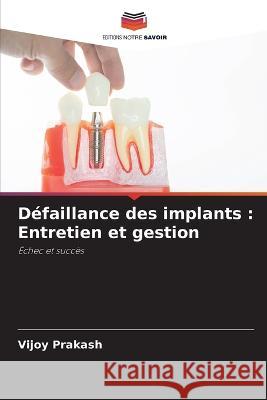 Defaillance des implants: Entretien et gestion Vijoy Prakash   9786205662298 Editions Notre Savoir - książka