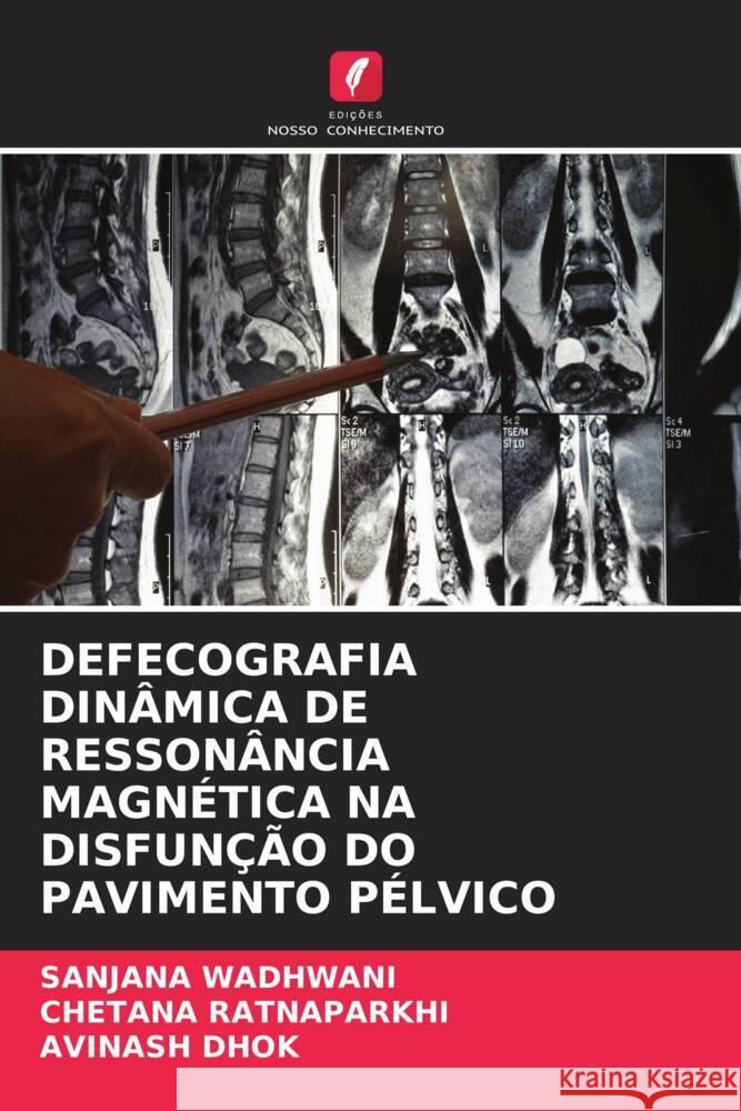 DEFECOGRAFIA DINÂMICA DE RESSONÂNCIA MAGNÉTICA NA DISFUNÇÃO DO PAVIMENTO PÉLVICO Wadhwani, Sanjana, Ratnaparkhi, Chetana, Dhok, Avinash 9786204812267 Edições Nosso Conhecimento - książka