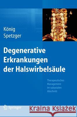 Degenerative Erkrankungen Der Halswirbelsäule: Therapeutisches Management Im Subaxialen Abschnitt König, Stefan Alexander 9783662435618 Springer - książka