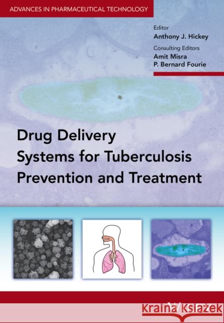 Delivery Systems for Tuberculosis Prevention and Treatment Hickey, Anthony J. 9781118943175 John Wiley & Sons - książka