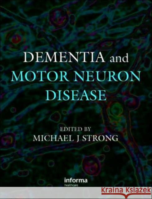 Dementia and Motor Neuron Disease Michael J. Strong Strong J. Strong Michael J. Strong 9780415391665 Informa Healthcare - książka