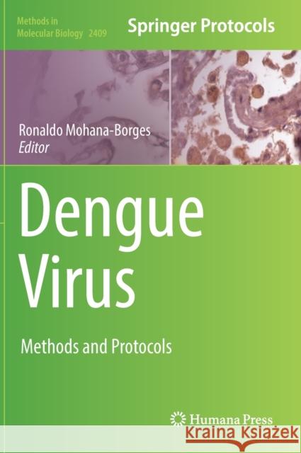 Dengue Virus: Methods and Protocols Ronaldo Mohana-Borges 9781071618783 Humana - książka