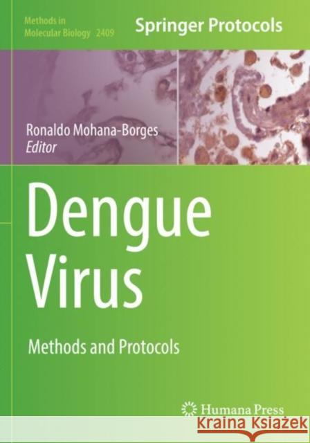 Dengue Virus: Methods and Protocols Ronaldo Mohana-Borges 9781071618813 Humana - książka