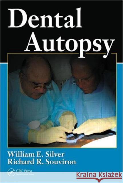 Dental Autopsy William E. Silver Richard R. Souviron 9781420070132 CRC - książka