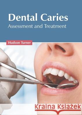 Dental Caries: Assessment and Treatment Hudson Turner 9781639891481 States Academic Press - książka