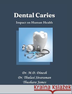 Dental Caries: Impact on Human Health Thulasi Sivaraman Thushara James M. D. Dinesh 9788197863653 Foxgales Publication - książka