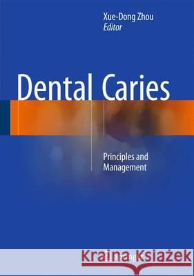 Dental Caries: Principles and Management Xuedong, Zhou 9783662474495 Springer - książka