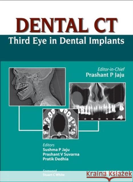 Dental CT Third Eye in Dental Implants Prashant P Jaju 9789350259108  - książka