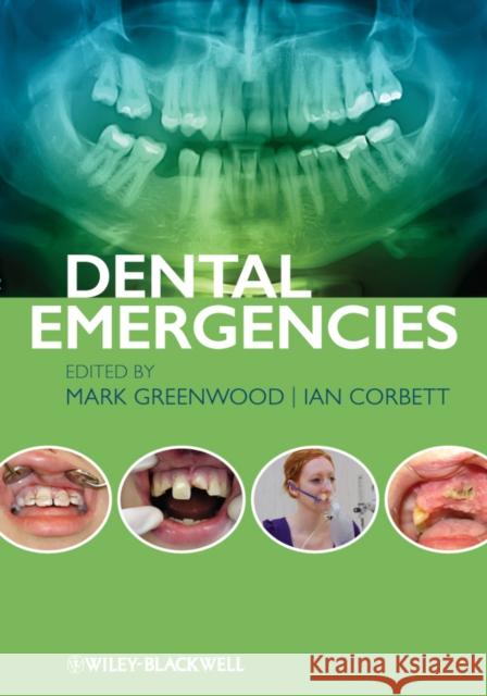 Dental Emergencies Mark Greenwood 9780470673966  - książka