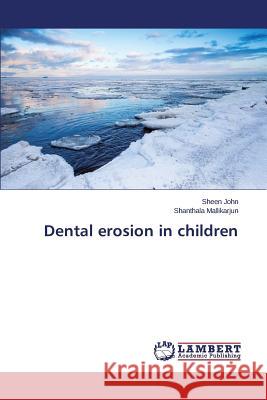 Dental erosion in children Mallikarjun Shanthala                    John Sheen 9783659698606 LAP Lambert Academic Publishing - książka