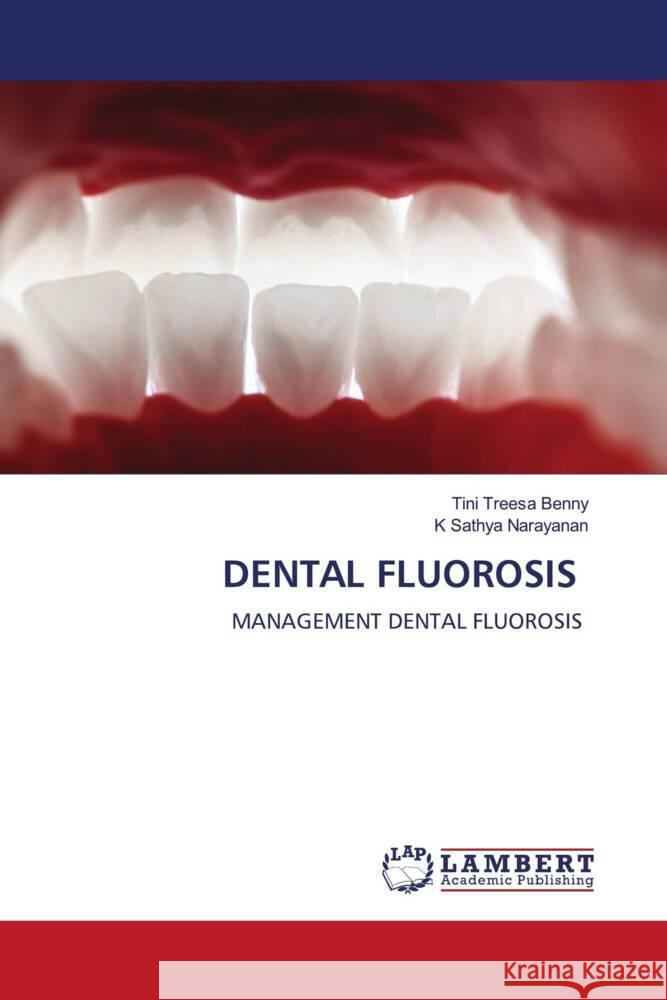 DENTAL FLUOROSIS Benny, Tini Treesa, Narayanan, K Sathya 9786208441654 LAP Lambert Academic Publishing - książka