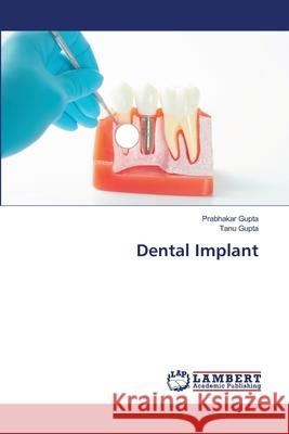 Dental Implant Prabhakar Gupta, Tanu Gupta 9786202565769 LAP Lambert Academic Publishing - książka