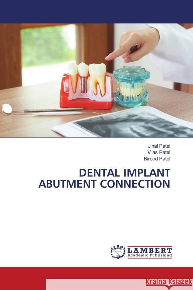 Dental Implant Abutment Connection Jinal Patel Vilas Patel Birood Patel 9786207467235 LAP Lambert Academic Publishing - książka