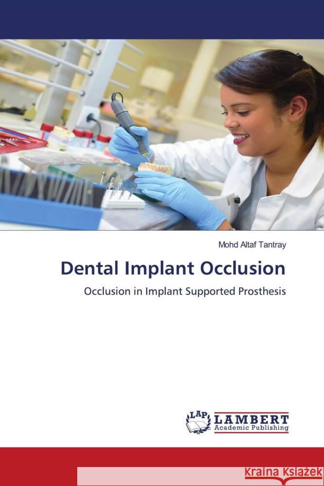 Dental Implant Occlusion Tantray, Mohd Altaf 9786205491195 LAP Lambert Academic Publishing - książka