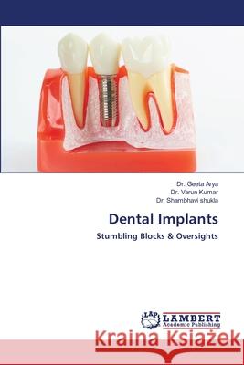 Dental Implants Arya, Dr. Geeta; Kumar, Varun; shukla, Dr. Shambhavi 9786202803212 LAP Lambert Academic Publishing - książka