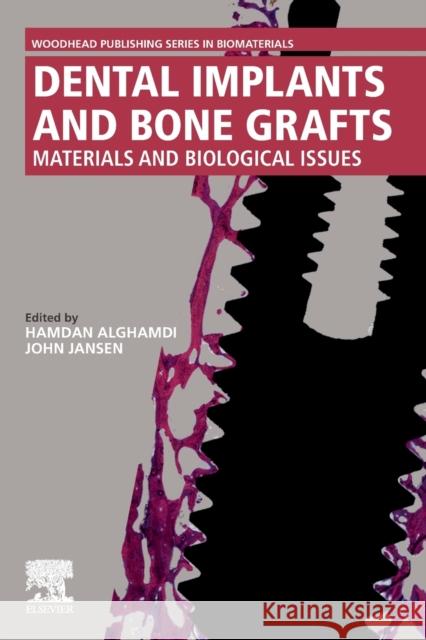 Dental Implants and Bone Grafts: Materials and Biological Issues Alghamdi, Hamdam 9780081024782 Woodhead Publishing - książka