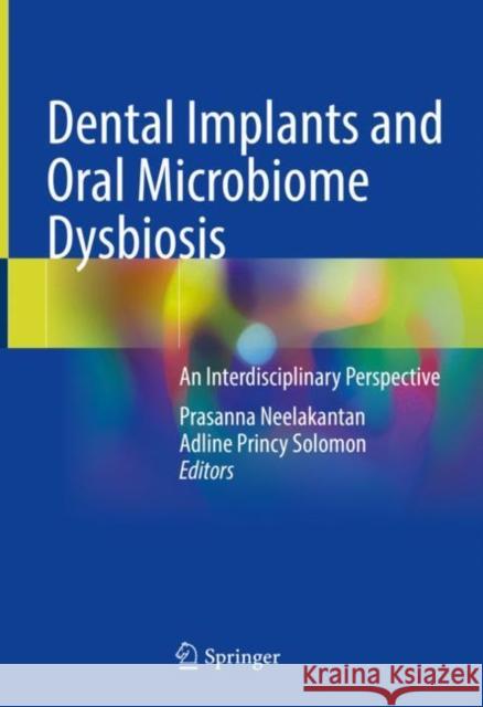 Dental Implants and Oral Microbiome Dysbiosis: An Interdisciplinary Perspective Neelakantan, Prasanna 9783030990138 Springer International Publishing - książka