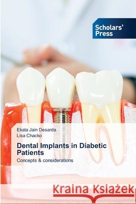 Dental Implants in Diabetic Patients Ekata Jai Lisa Chacko 9786208848101 Scholars' Press - książka