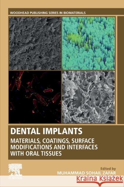 Dental Implants: Materials, Coatings, Surface Modifications and Interfaces with Oral Tissues Muhammad Sohail Zafar Zohaib Khurshid 9780128195864 Woodhead Publishing - książka