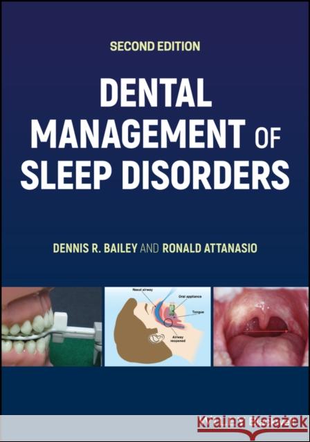 Dental Management of Sleep Disorders Dennis R. Bailey 9781118636688 John Wiley & Sons Inc - książka