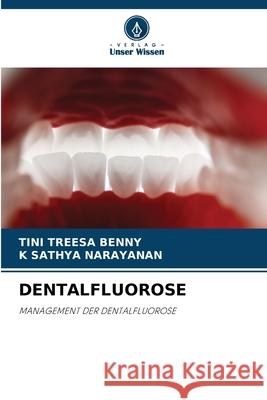 DENTALFLUOROSE Benny, Tini Treesa, Narayanan, K Sathya 9786200711861 Verlag Unser Wissen - książka