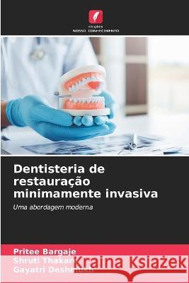 Dentisteria de restauracao minimamente invasiva Pritee Bargaje Shruti Thakare Gayatri Deshmukh 9786206045618 Edicoes Nosso Conhecimento - książka