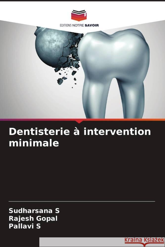 Dentisterie à intervention minimale S, Sudharsana, Gopal, Rajesh, S, Pallavi 9786204411101 Editions Notre Savoir - książka