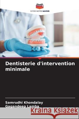 Dentisterie d'intervention minimale Khondalay, Samrudhi, Lamba, Gagandeep 9786208808709 Editions Notre Savoir - książka