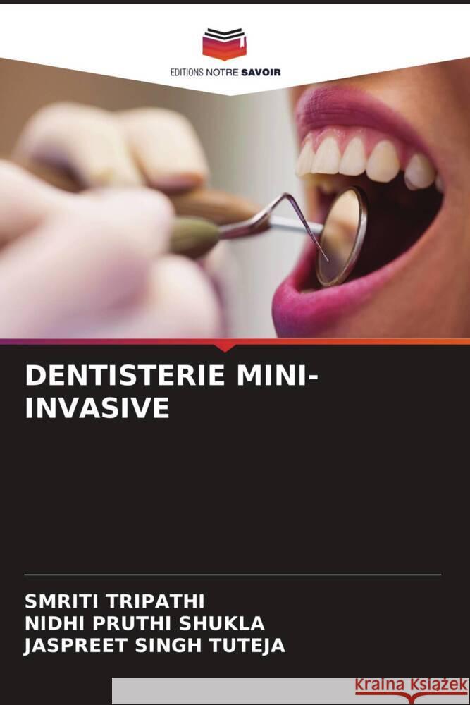 DENTISTERIE MINI-INVASIVE Tripathi, Smriti, PRUTHI SHUKLA, NIDHI, SINGH TUTEJA, JASPREET 9786205054321 Editions Notre Savoir - książka