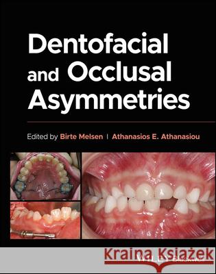 Dentofacial and Occlusal Asymmetries Melsen 9781119794813 John Wiley and Sons Ltd - książka